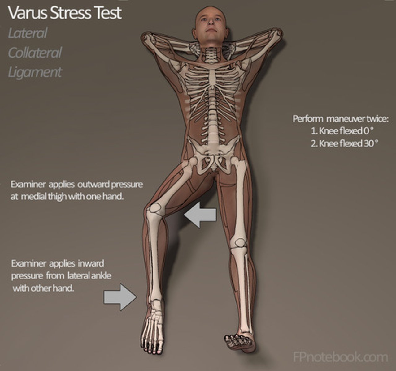<p>LCL injury</p>