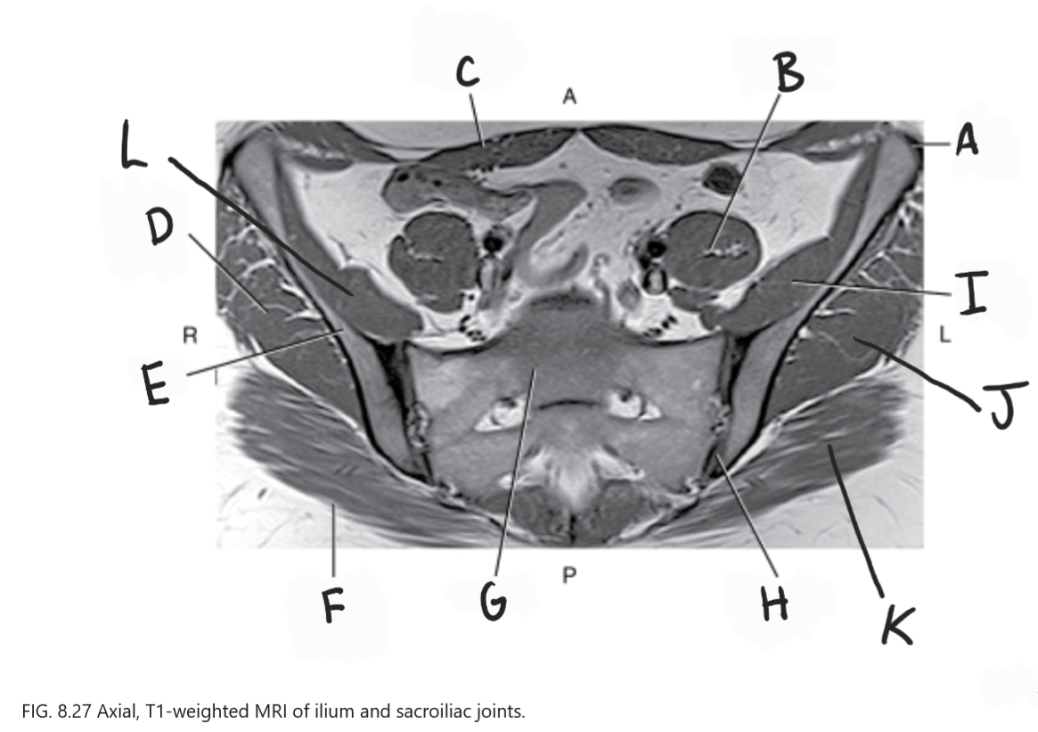 <p>What is G</p>