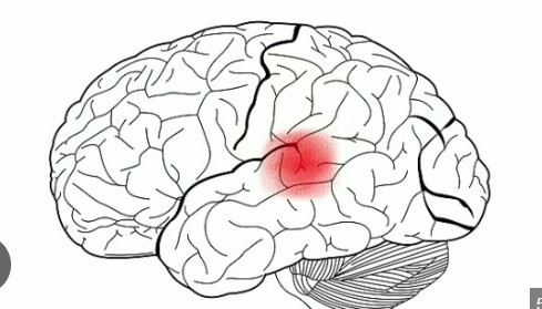 <p><span>The</span><mark data-color="#81aa98" style="background-color: rgb(129, 170, 152); color: inherit;"><span> auditory cortex </span></mark><span>is </span><strong><mark data-color="rgba(0, 0, 0, 0)" style="background-color: rgba(0, 0, 0, 0); color: inherit;">the part of the brain in the temporal lobe responsible for processing sounds, including speech and music. Located in the temporal lobe.</mark></strong></p>