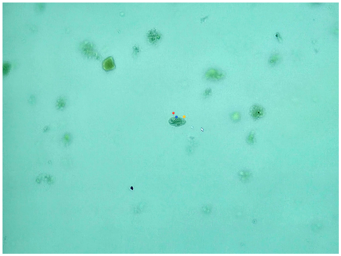 <p><strong><em>Giardia intestinalis</em></strong></p><p>(Cysta)</p><p></p><p></p><p><strong>Organelle:</strong></p><p></p><ul><li><p><span data-name="red_circle" data-type="emoji">🔴</span><span> - jądro komórkowe;</span></p></li></ul><p></p><ul><li><p><span data-name="blue_circle" data-type="emoji">🔵</span><span> - ciałko sierpowate;</span></p></li></ul><p></p><ul><li><p><span data-name="yellow_circle" data-type="emoji">🟡</span><span> - aksonema.</span></p></li></ul><p></p><p></p><p><strong>Parazytoza:</strong> <em>Giardioza</em></p><p></p>