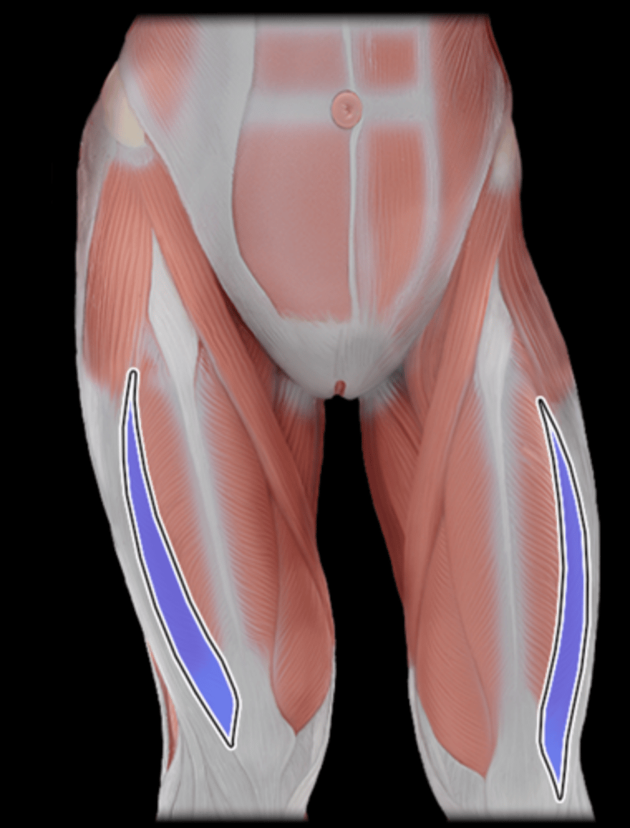 <p>What Muscle Is Highlighted?</p>