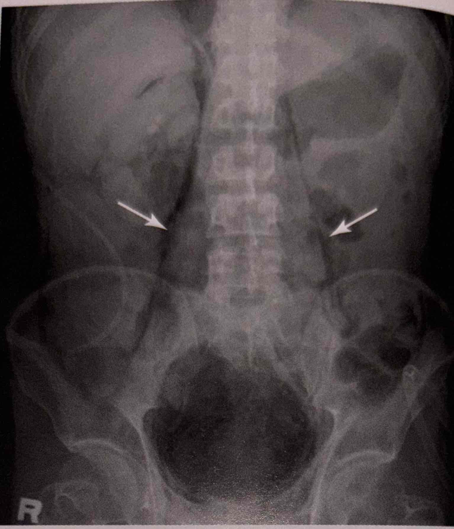 <p>What are the arrows pointing to?</p>