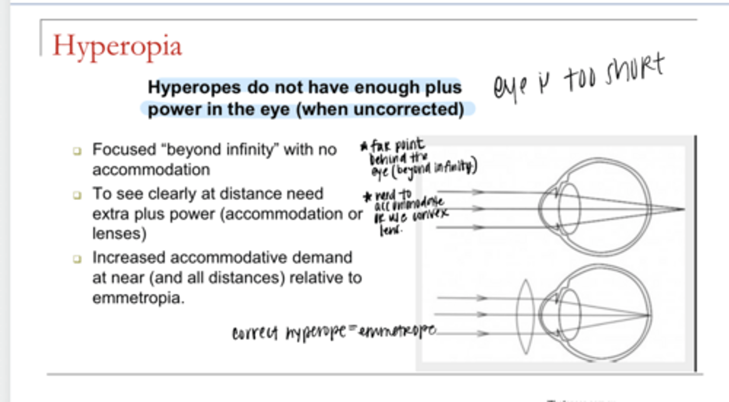 <p>To see clearly at distance, what do hyperopes have to do?</p>
