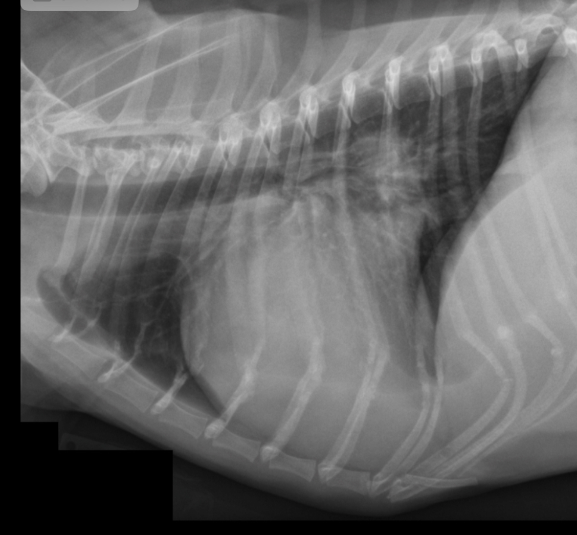 <p>What part of the heart is enlarged</p>