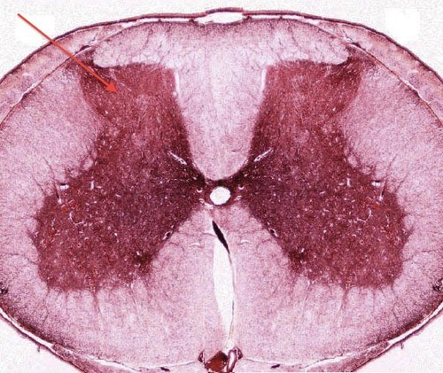 <p>What type of tissue is this? (Red arrow)</p>
