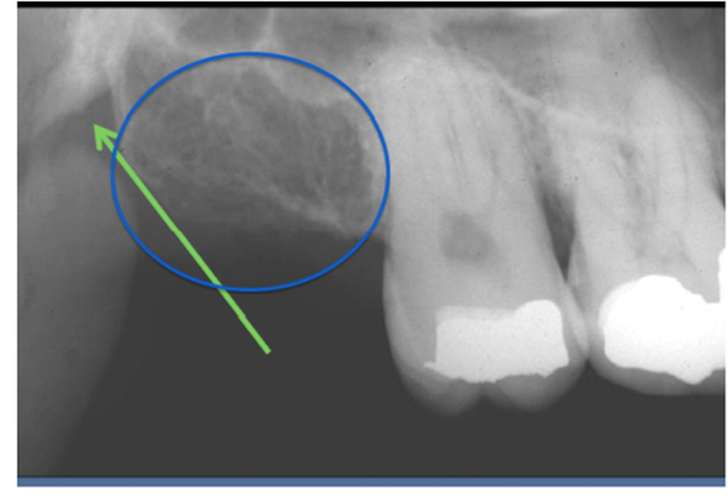 <p>Identify the triangular space the green arrow is pointing too. <br>Identify what is circled in blue</p>
