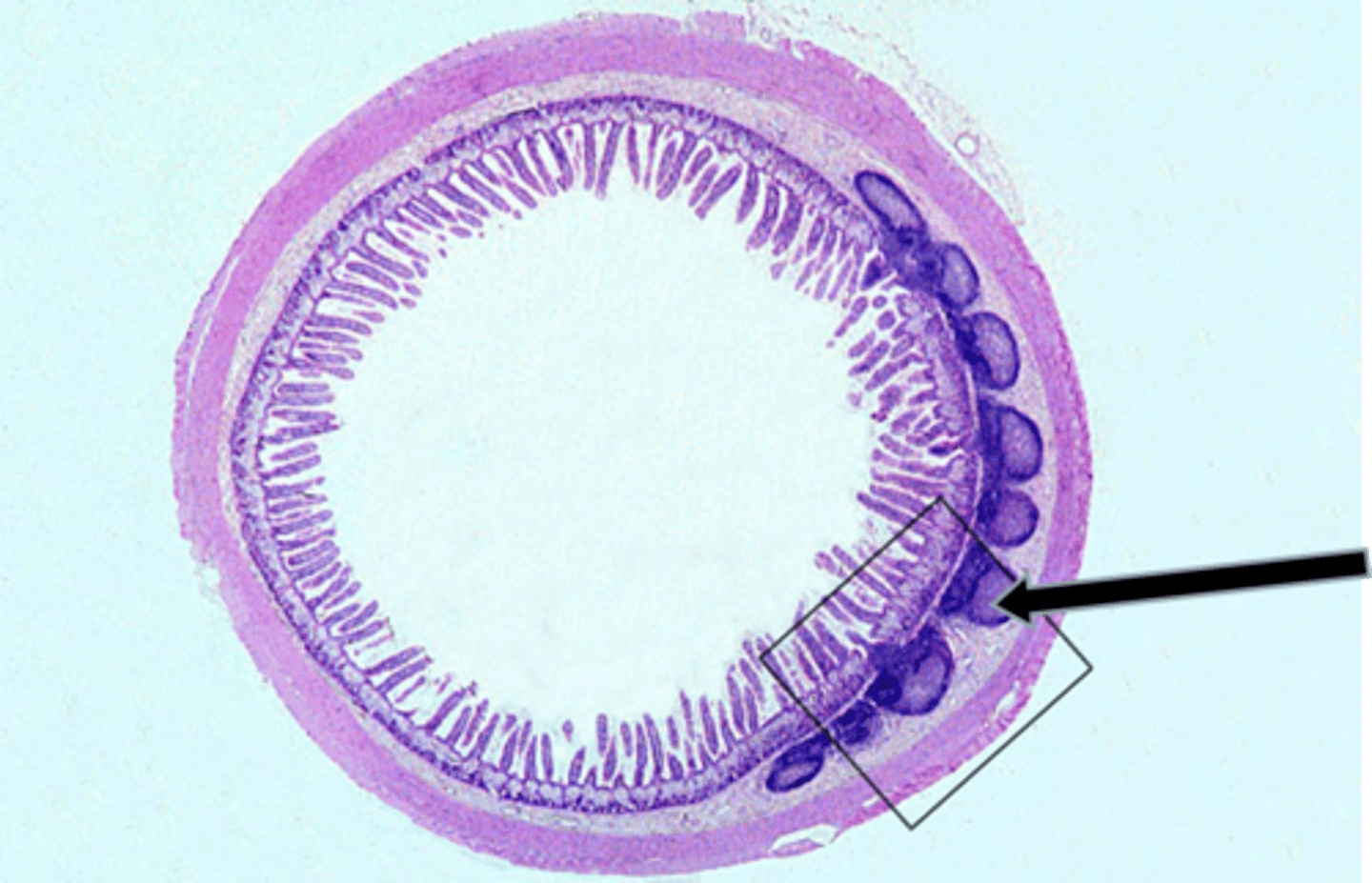 <p>black arrow</p><p>secondary lymphatic nodule</p>