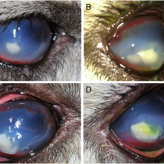 <p>A pocket of infection of corneal tissue that usually manifests as a light grey or soft pink haze in its early stages</p>