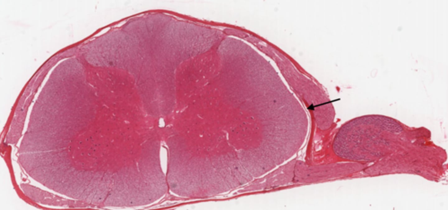 <p>Identify the part of the meninges</p>
