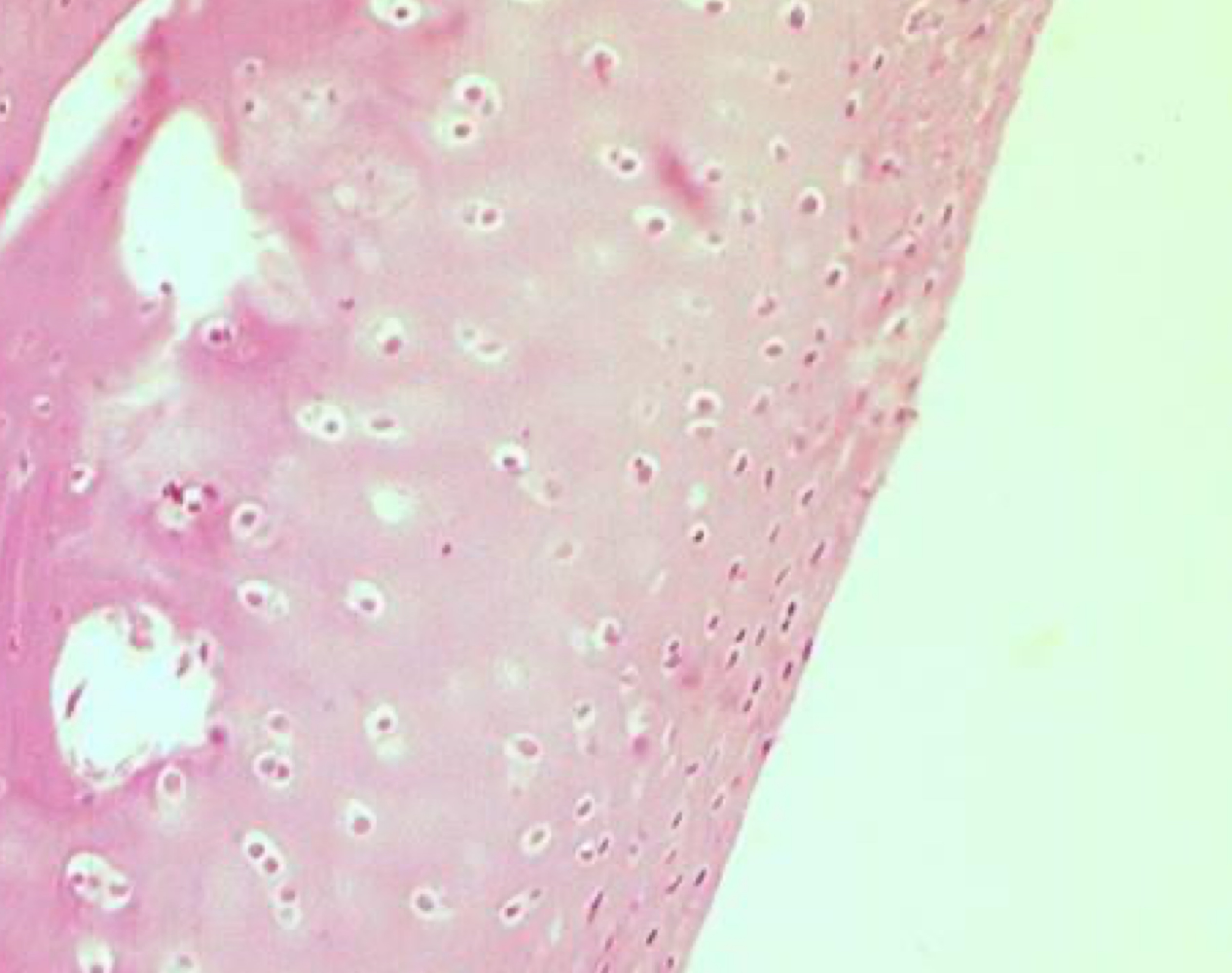 <p>dark pink dots within white spaces = chondrocytes</p>