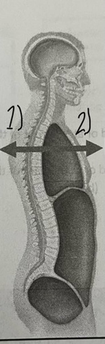 <p>What does #2 represent on the picture? (think of the front)</p>