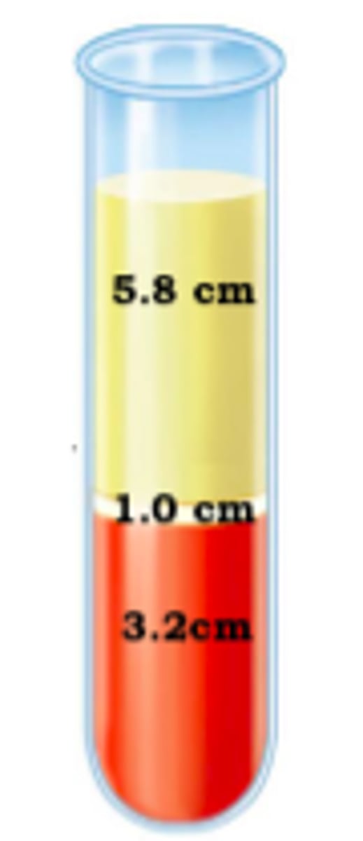 <p>32%</p>