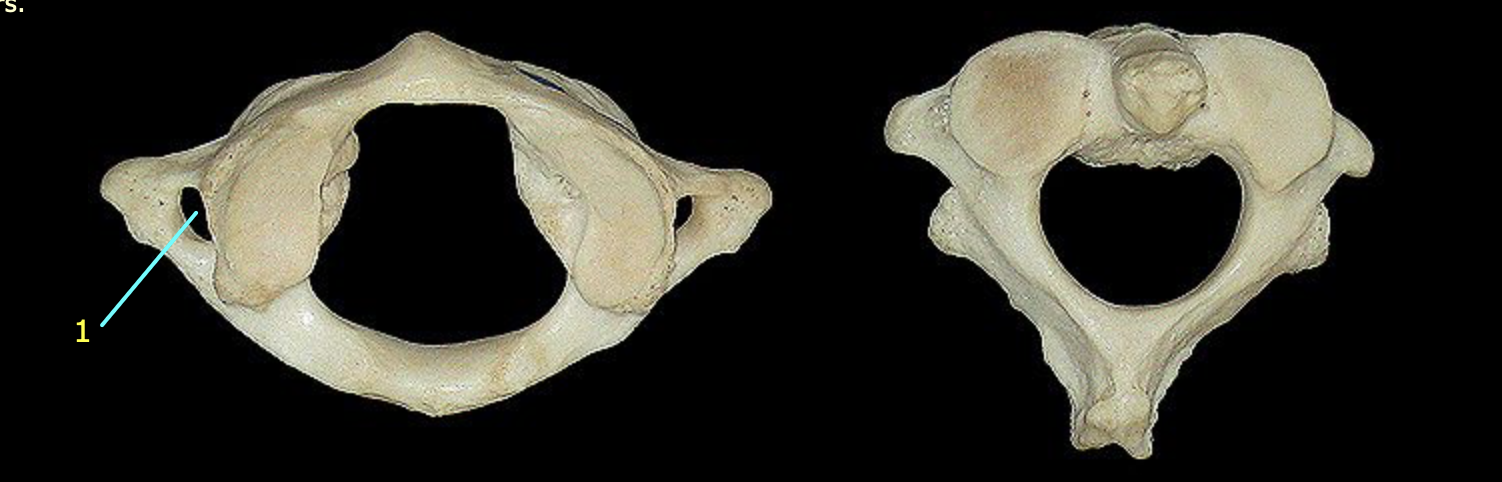 <p>What structures are these?</p>