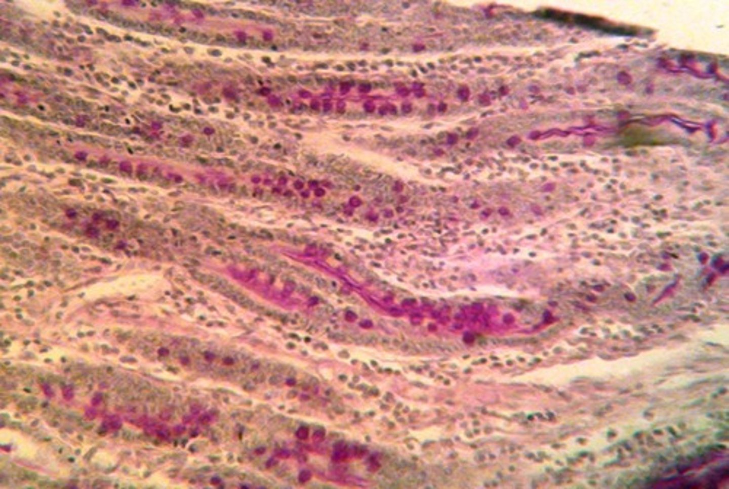 <p>It stains neutral polysaccharides and basement membranes magenta. It is used to identify fungal infections or thickening of the basement membrane in kidney disease.</p>