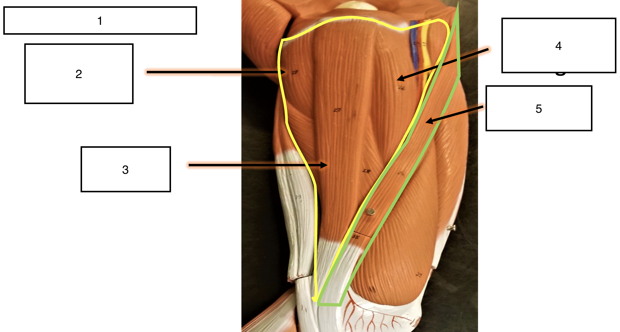 <p>name the muscle (5)</p>