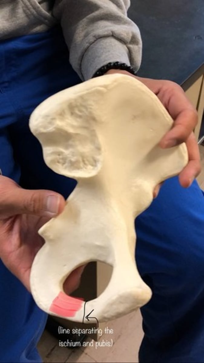 <p>arch outside of notch; first half on the ischium</p>
