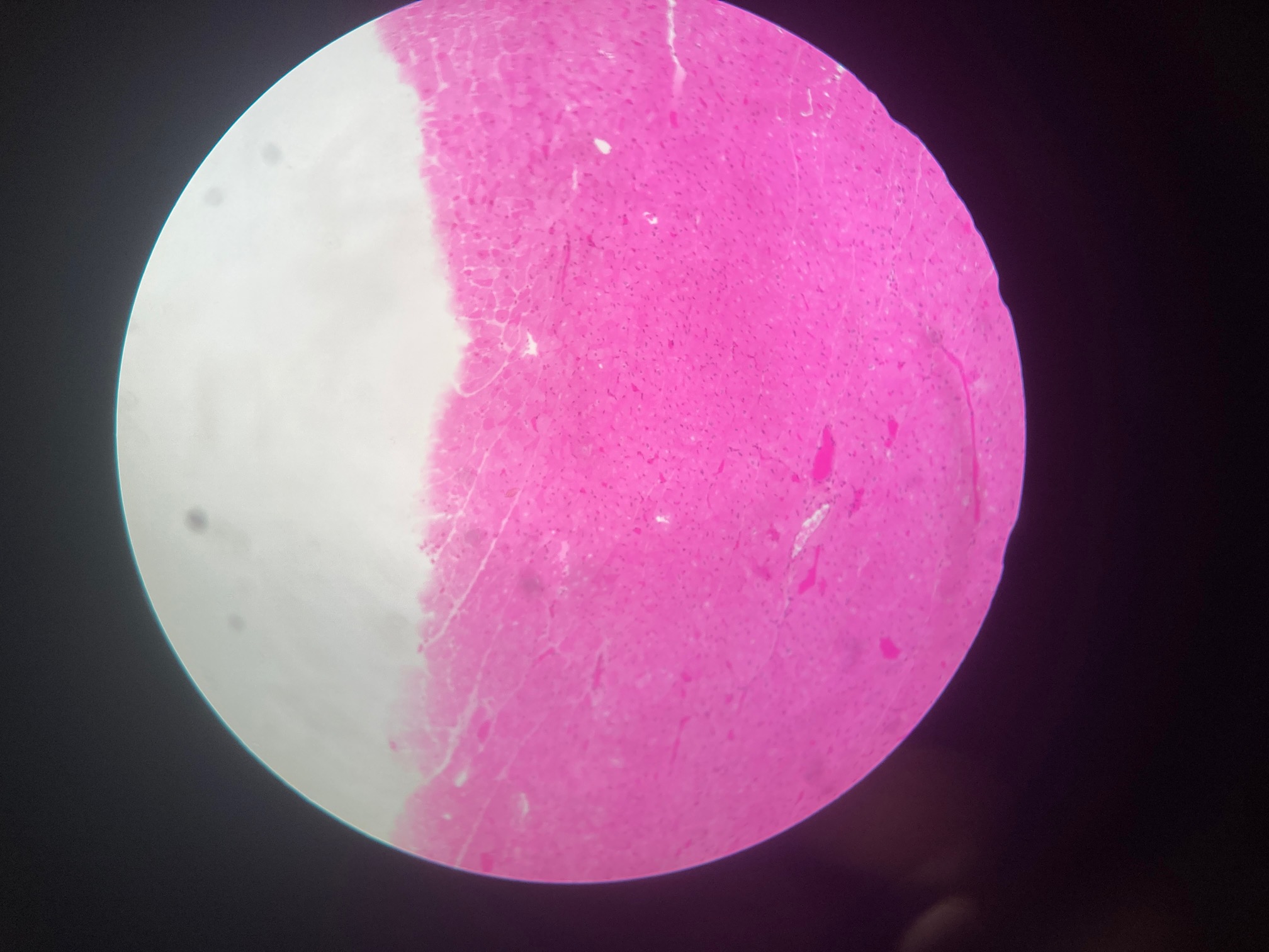 <p>Cardiac muscle</p><p>Pink rectangle</p><p>Intercalated discs, centrally located nuclei</p>