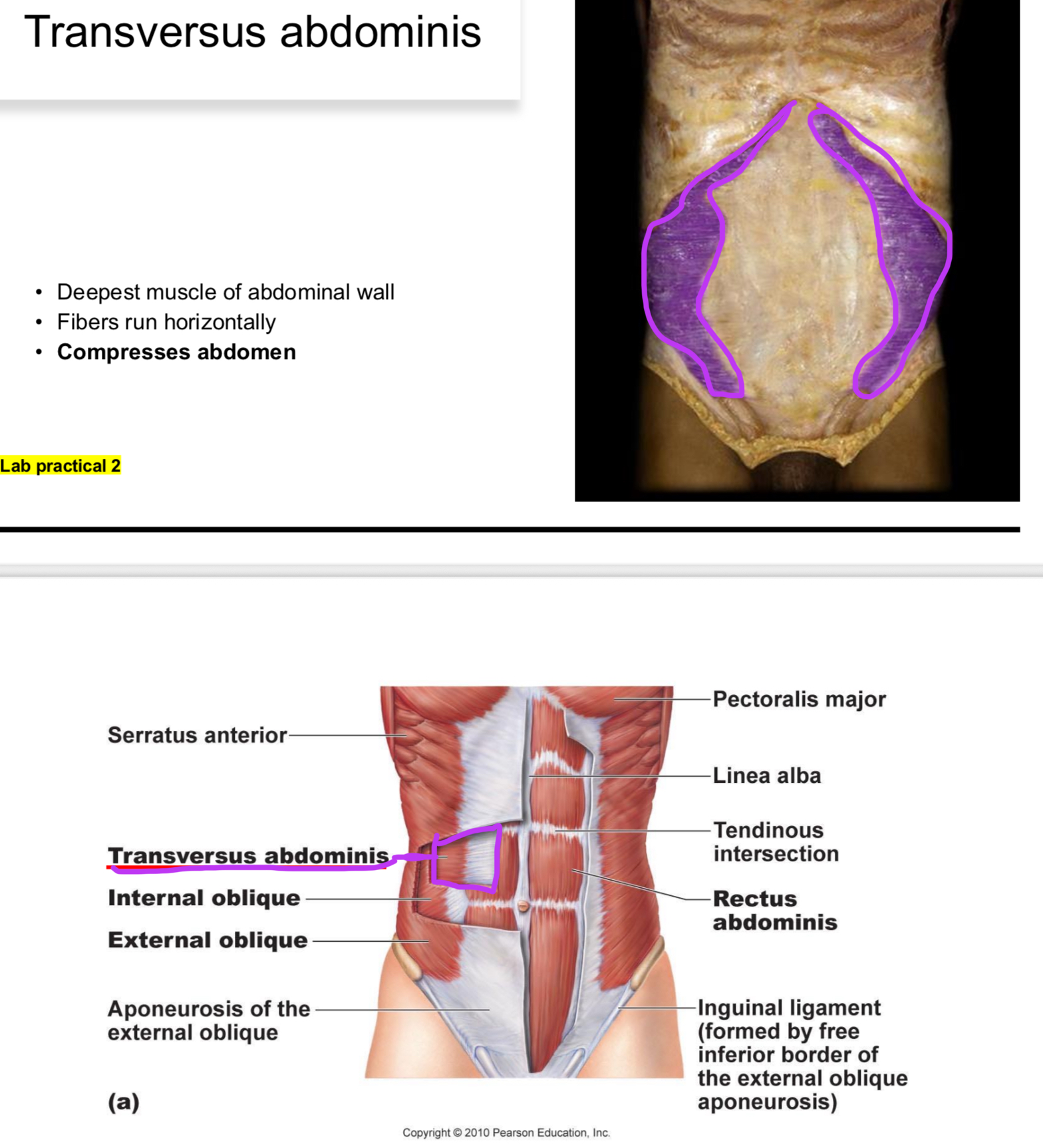<p>Assists in compressing the abdomen.</p>