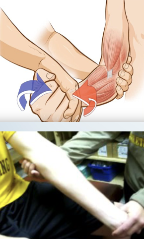 <p>Medial epicondylitis: Reverse Cozen’s, Reverse Mill’s</p>