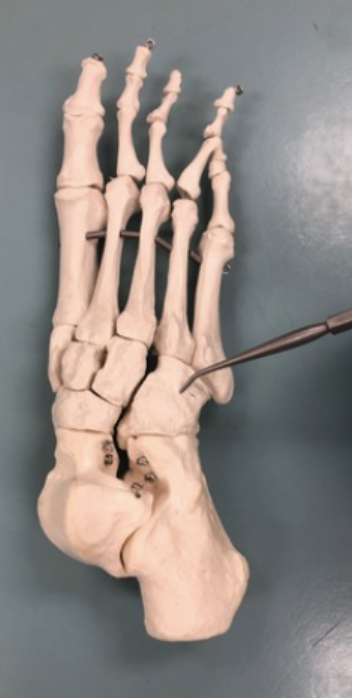 <p><span style="font-family: -apple-system, system-ui, Segoe UI, Roboto, Helvetica Neue, Arial, Noto Sans, Liberation Sans, sans-serif, Apple Color Emoji, Segoe UI Emoji, Segoe UI Symbol, Noto Color Emoji">Identify this bone.&nbsp;</span></p>