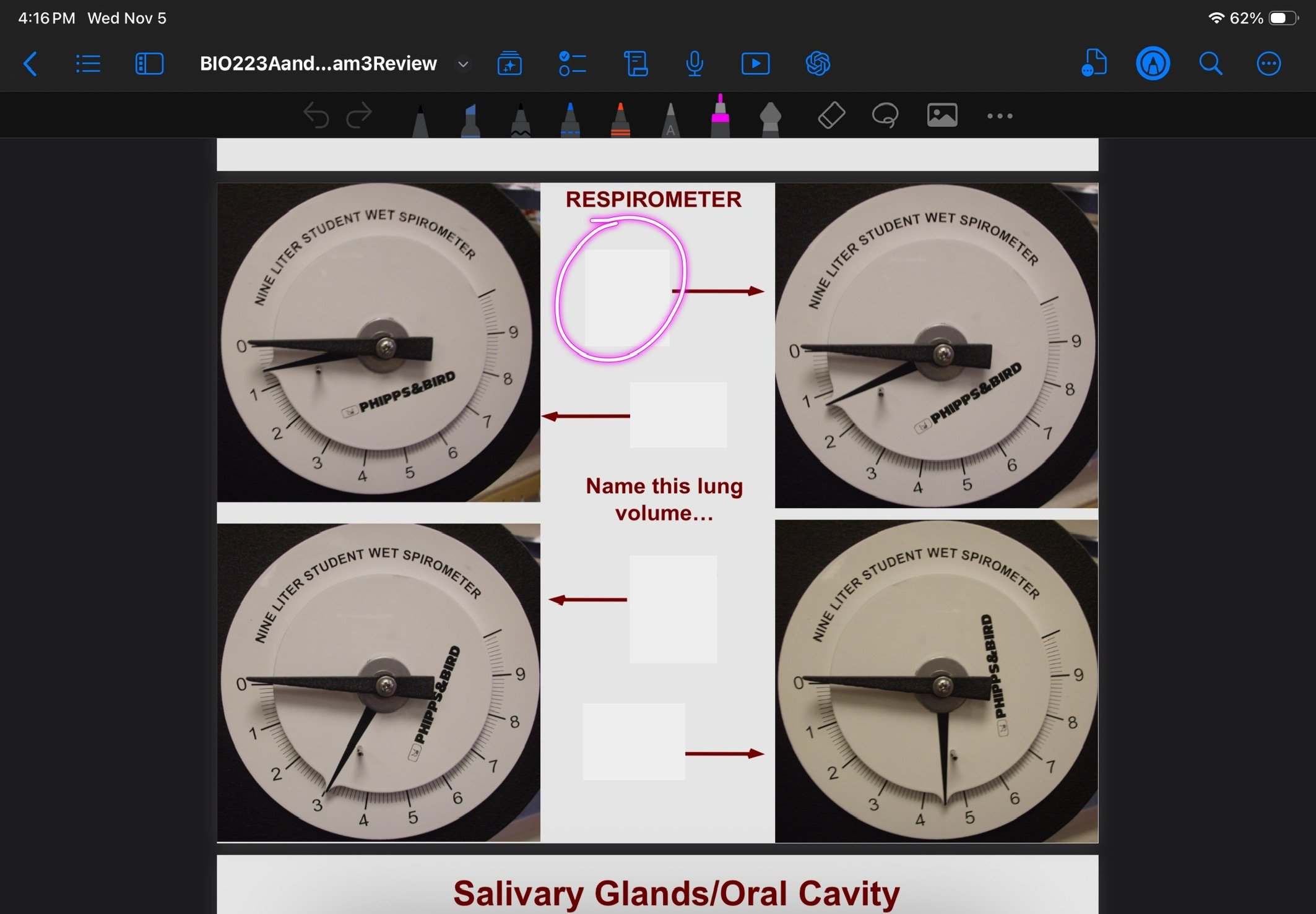 <p>Lung volume of ERV</p>