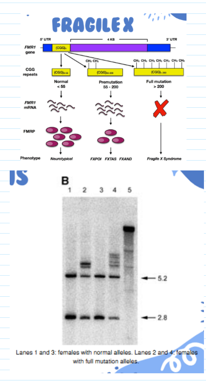 <ul><li><p><span>Extensive repeat extension (&gt;200) leads to methylation of C residues in CpG islands</span></p></li><li><p><span>RFLP results from loss of cutting by methylation-sensitive restriction enzymes (e.g. Xhol)</span></p></li><li><p><span>RFLP detected by hybridization with FMR probe</span></p></li><li><p><span><u>Current diagnostic testing:</u></span></p><ul><li><p><span>PCR as first line test</span></p></li><li><p><span>Southern blot (RFLP) as follow up</span></p></li><li><p><span>Why not use PCR only?</span></p><ul><li><p><span>PCR doesn't give any information on methylation status and that is needed for diagnosis/severity</span></p></li></ul></li></ul></li></ul><p></p>