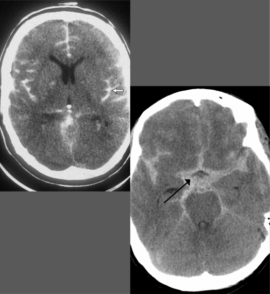 <p>What is this pathology?</p>