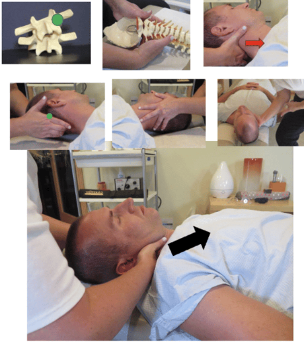 <p>• PP: Supine, asks permission to open gown/contact patient, verbalize finding the segment</p><p>• DP: Towards head of table, on side of contact, laterally flexing head toward contact, minimizing rotation, tissue slack S-I</p><p>• CH: Proximal metacarpophalangeal index of the hand corresponding to the side of segmental contact, on posterolateral articular pillar of superior vertebrae, fingers reinforce</p><p>• IH: #1-cradles patients head, supports contralateral occiput and upper cervical spine</p><p>• VEC: L-M and S-I• CLOSING THE WEDGE</p>