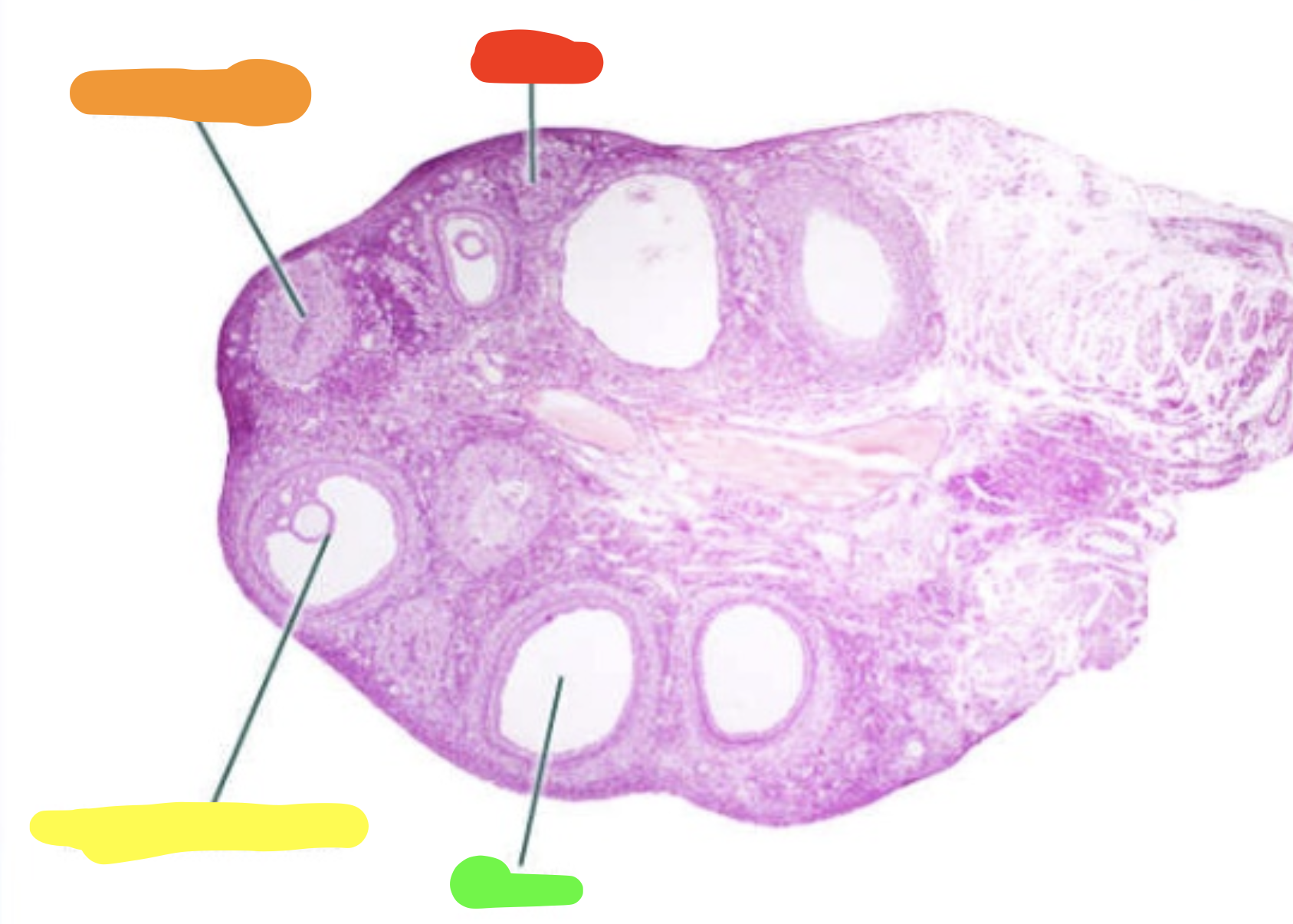 <p>What is this a slide of?</p>