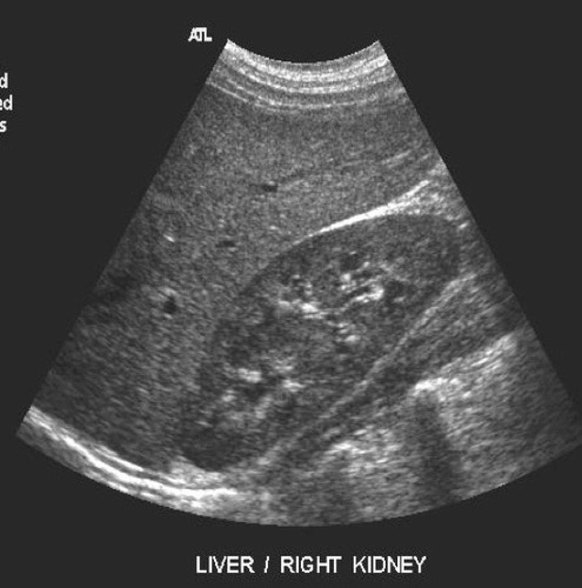 <p>What does this image represent</p>