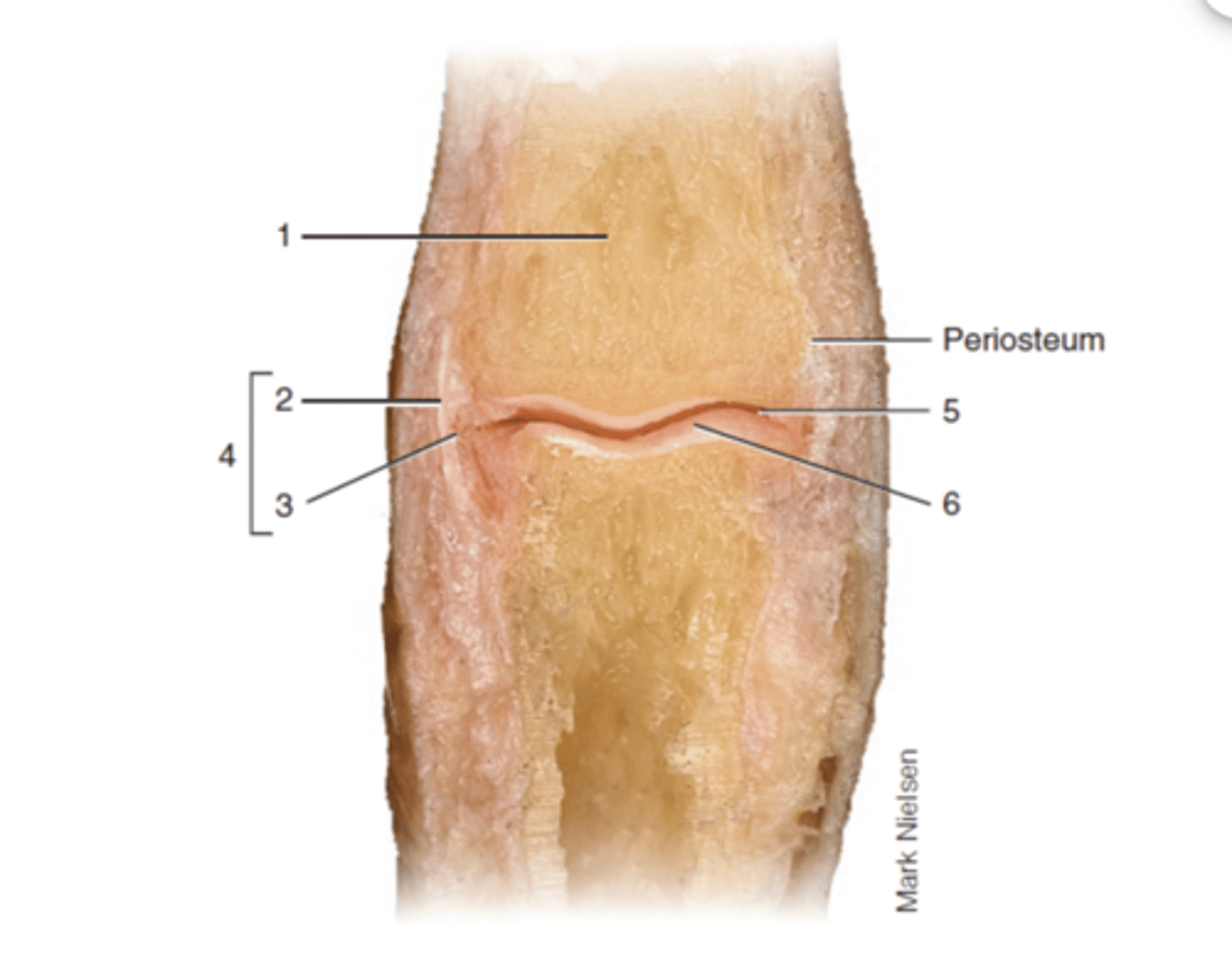 <p>articular capsule</p>