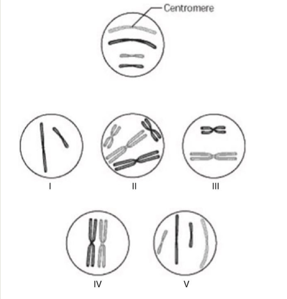 <p><span><span>Which chromosomal configuration would be observed at prometaphase of mitosis?</span></span></p>