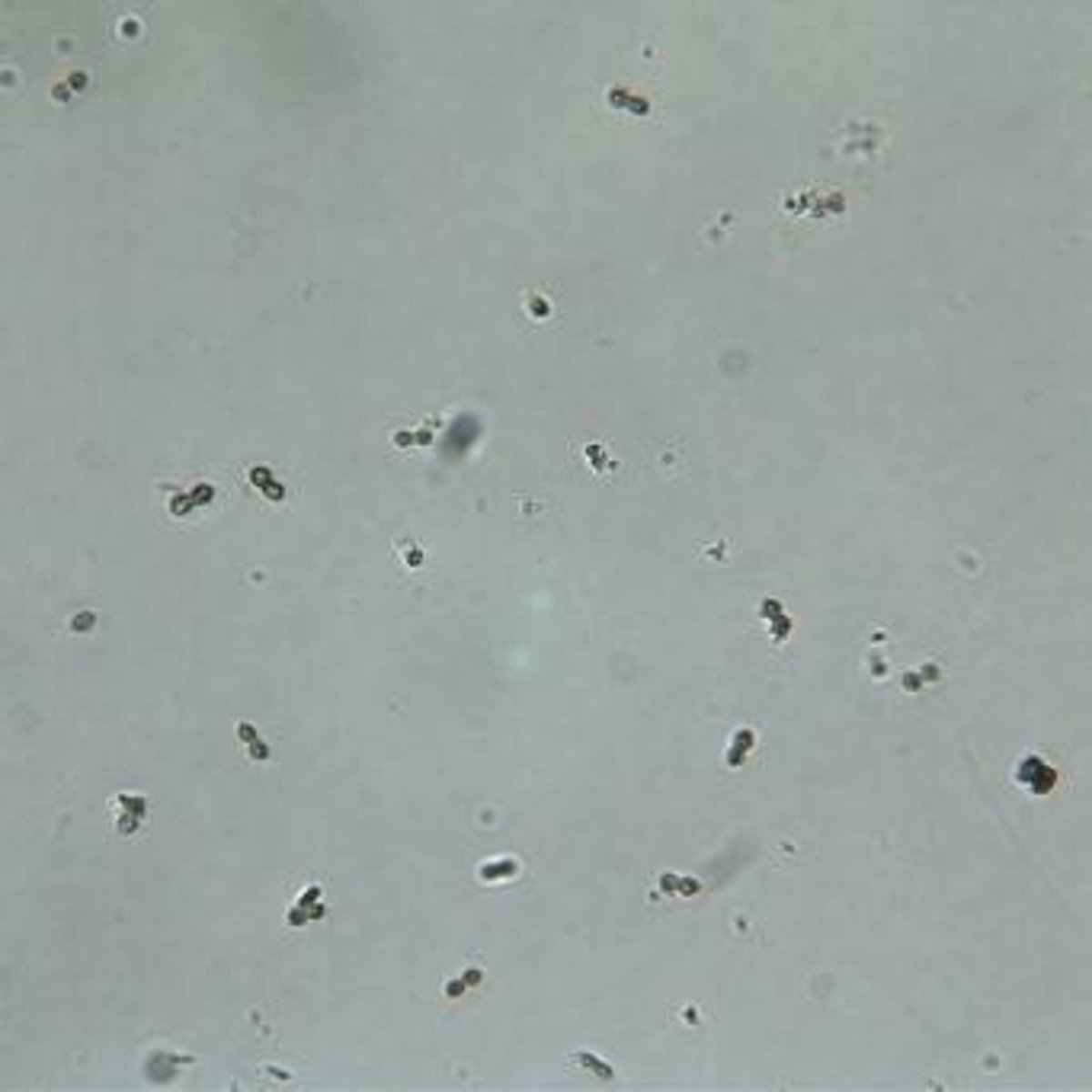 <p>Small, oval, refractile, observed under Brightfield at 40x.</p>