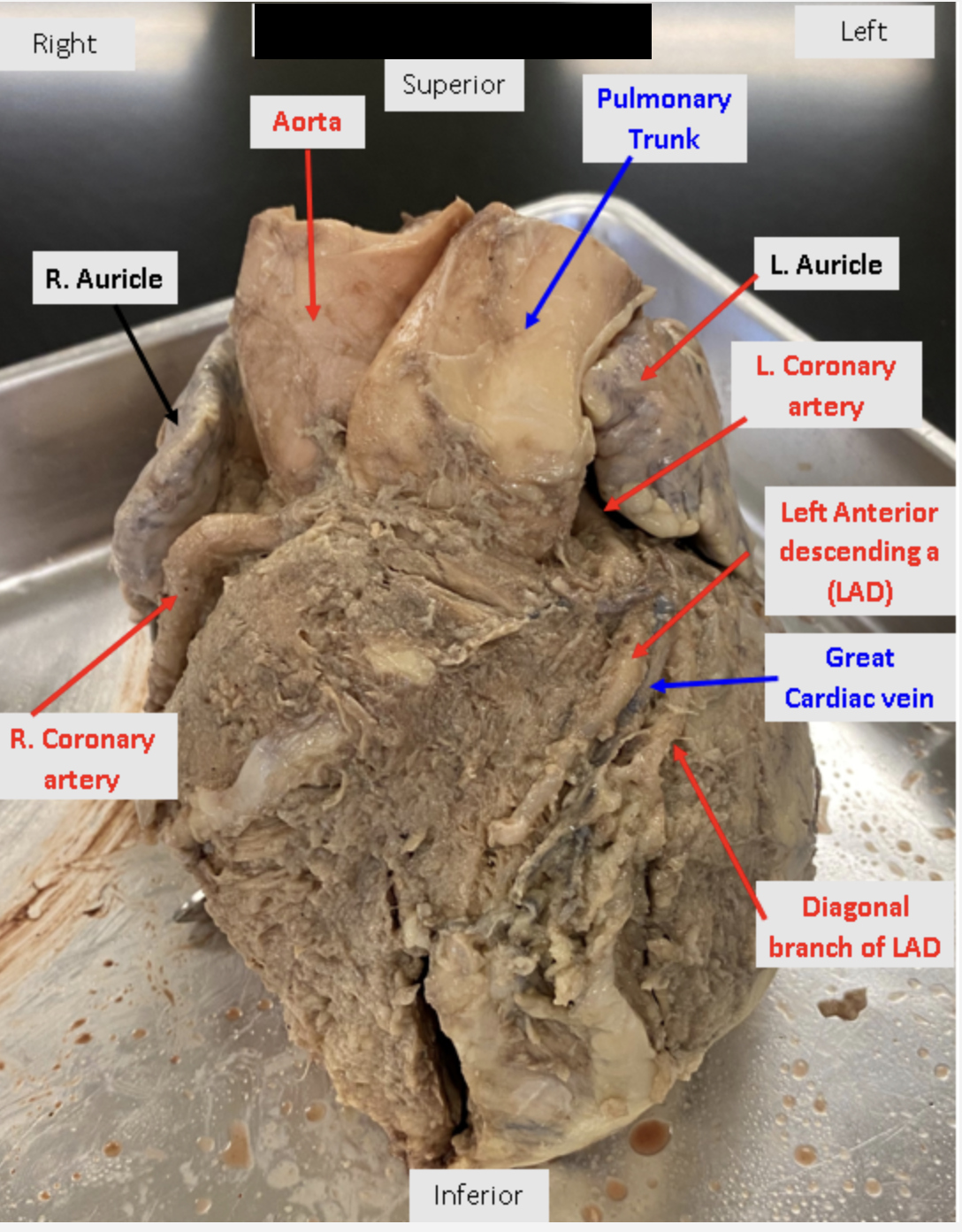 <p>what view of the heart is this?</p>