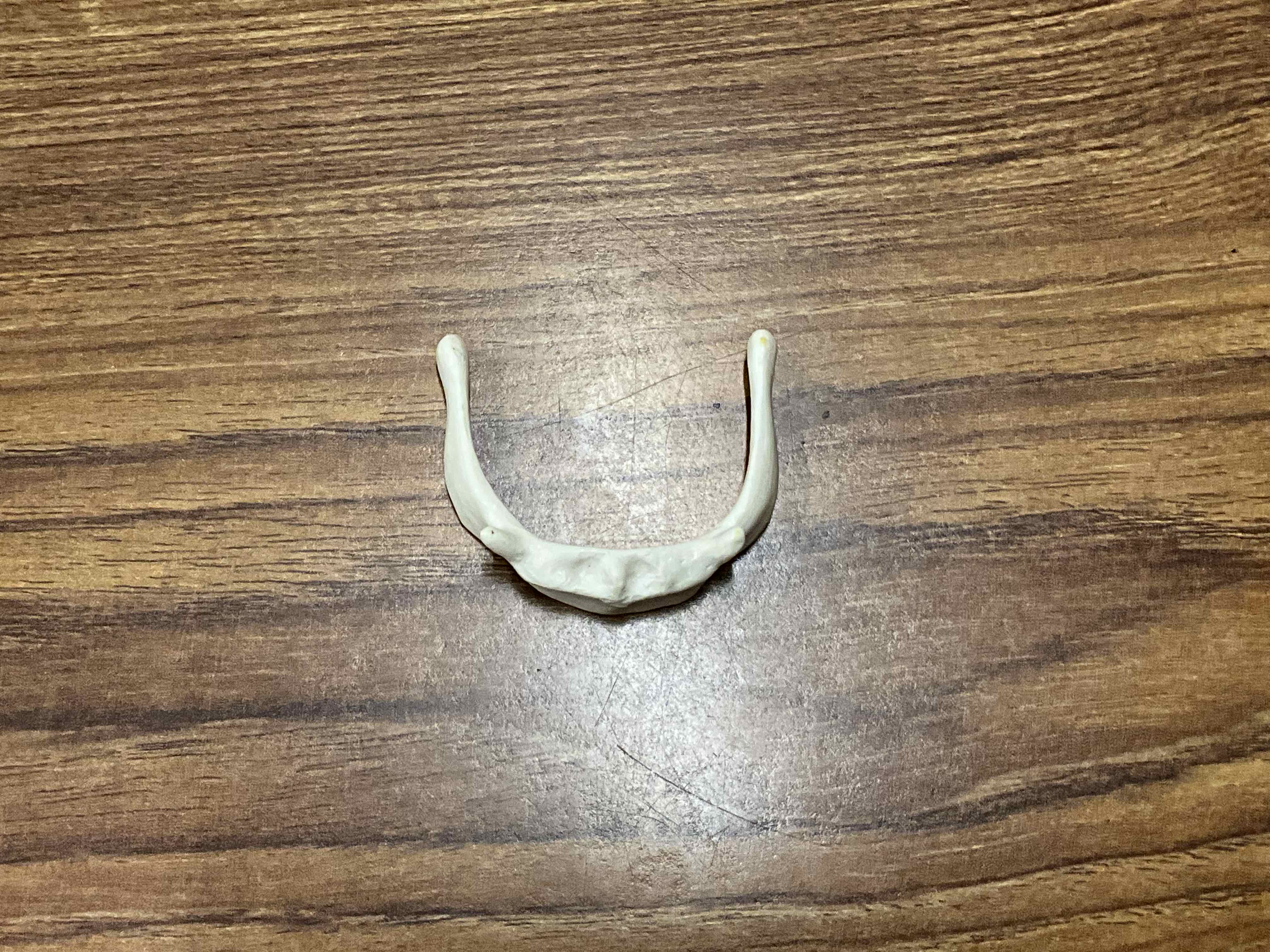 <p>Name the bone</p>