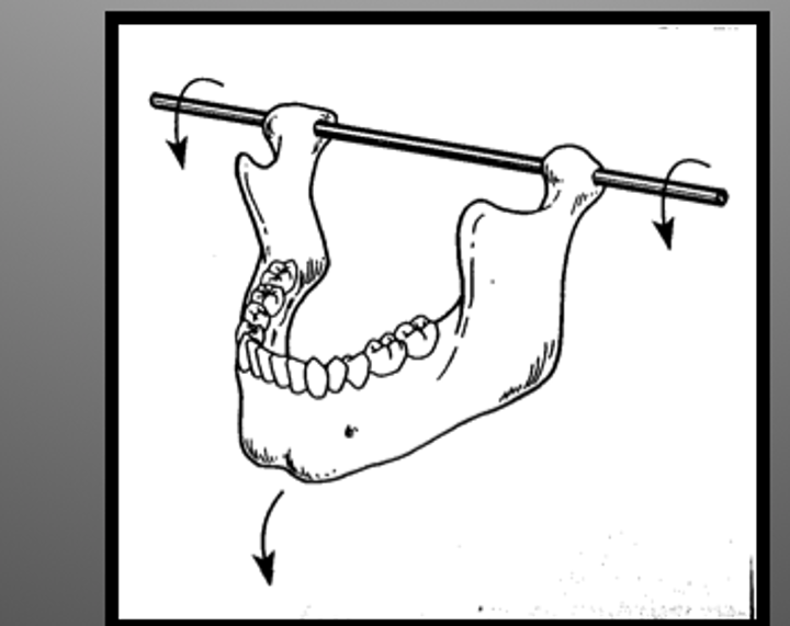 <p>an imaginary line around which the mandible may rotate within the sagittal plane</p>