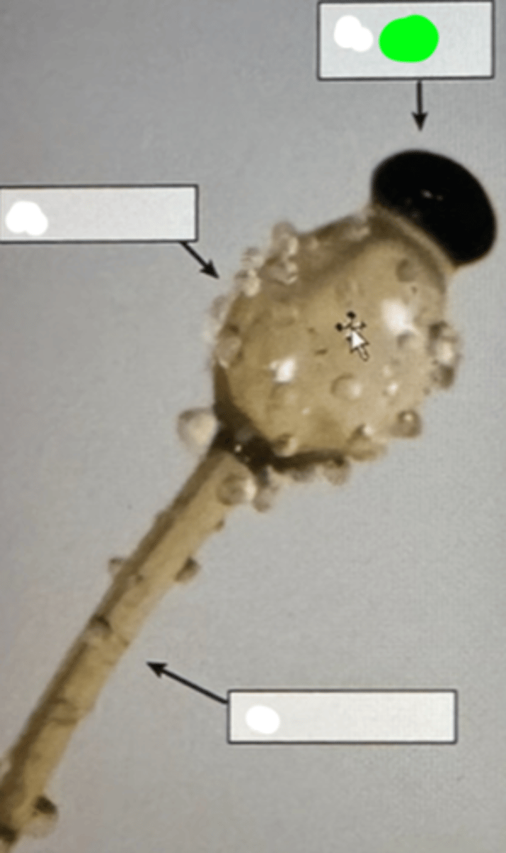 <p>Structure within which spores are produced and stored before release.</p>