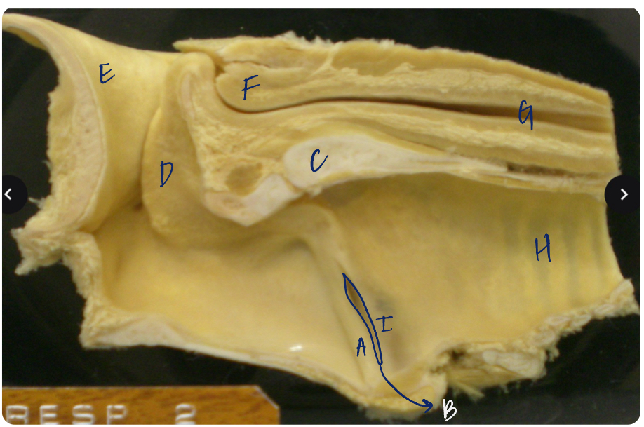 <p>F</p><p>(pig larynx median section)</p>