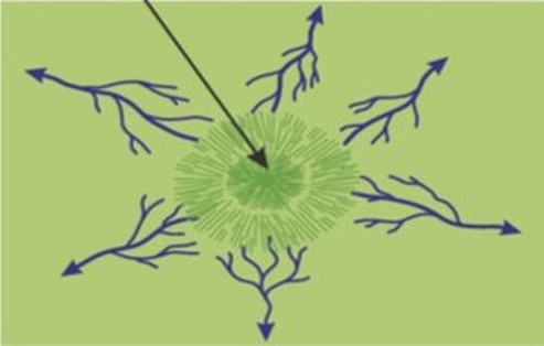<p>Radial</p>