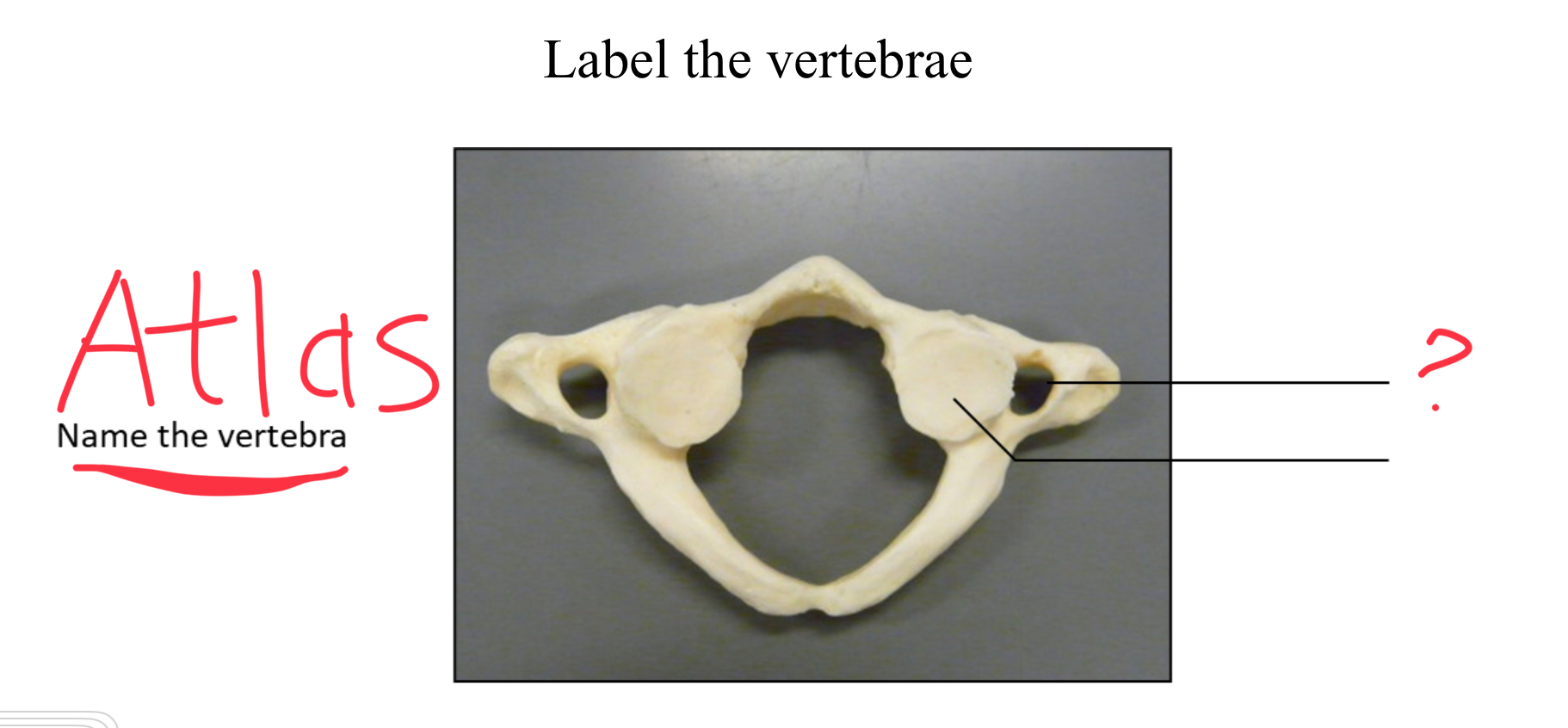 <p>Transverse foramen</p>