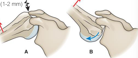 <p><mark data-color="yellow" style="background-color: yellow; color: inherit;">Center of rotation of the humeral head moves slightly superiorly</mark> during first <span style="color: red;"><span>60°</span></span>of elevation, then it stabilizes. </p>