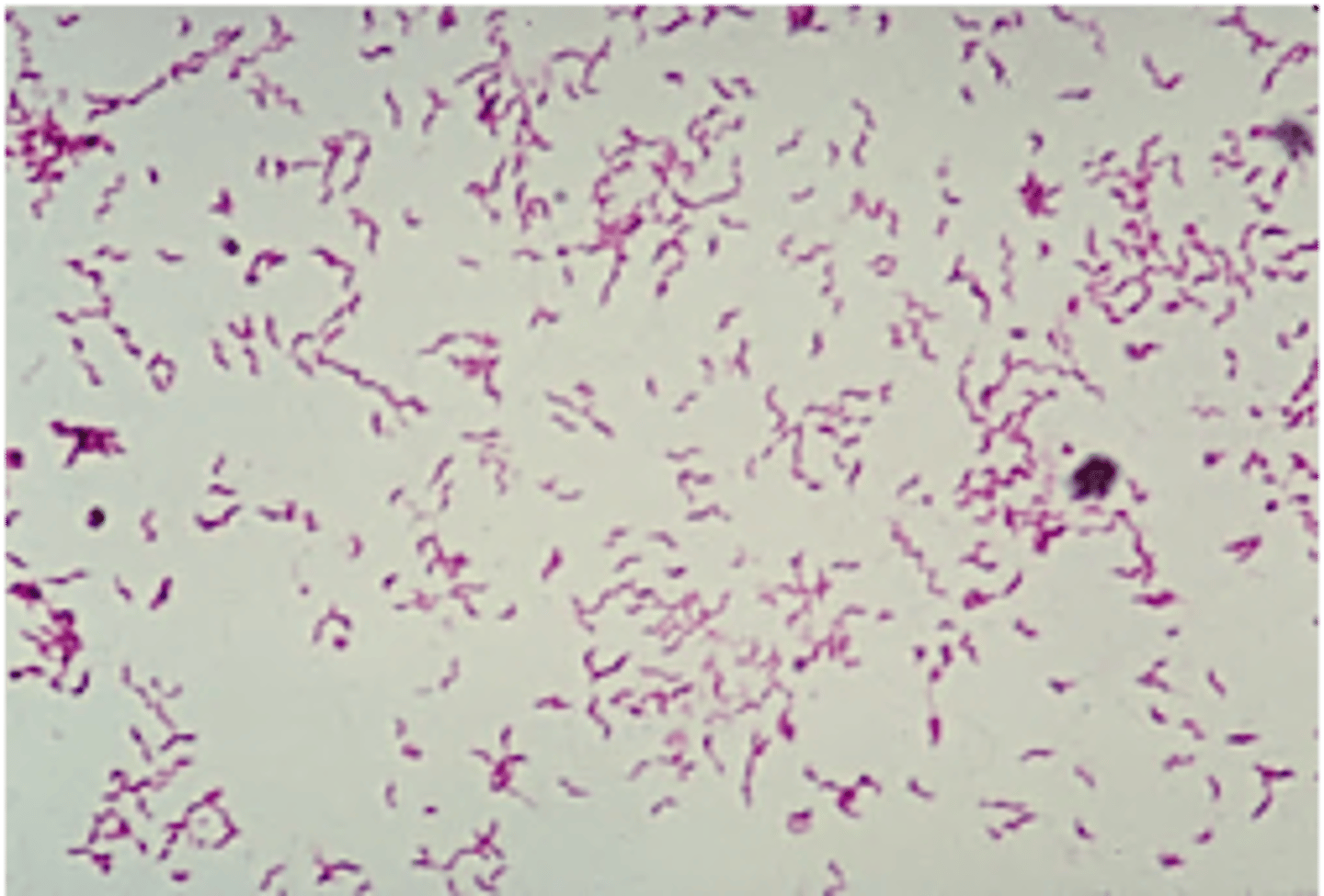 <p>what bacteria is indicated by this image and is associated with hemorrhagic enterocolitis</p>