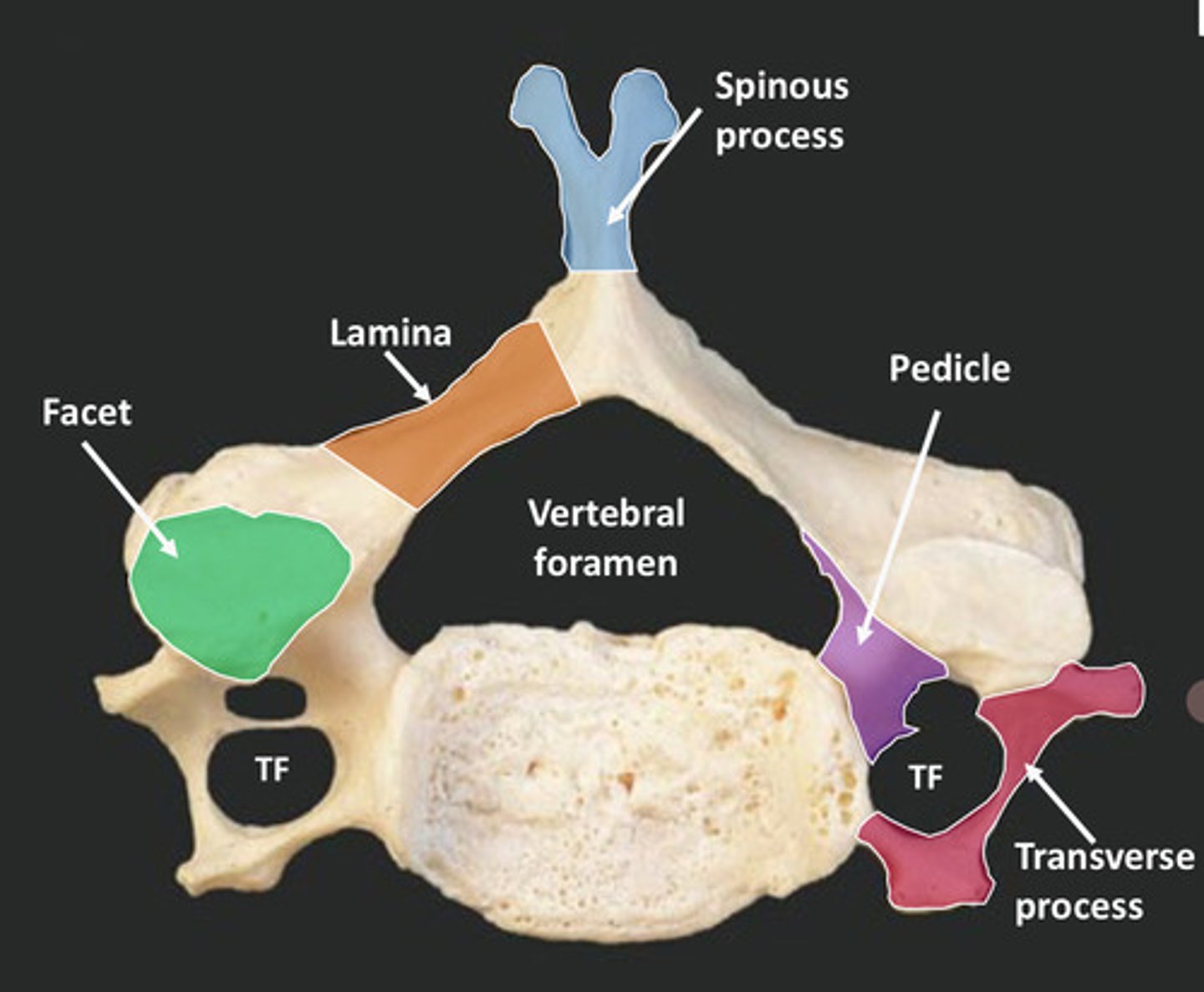 <p>know these</p><p>- Body</p><p>- Vertebral arch</p><p>- Vertebral foramen</p><p>- Pedicle</p><p>- Transverse process</p><p>- Spinous process</p><p>- Lamina</p><p>- Facet</p><p>- Intervertebral foramen</p>