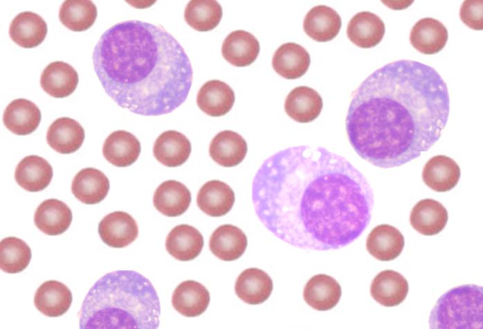 <ul><li><p>evolves from B lymphs and makes immunoglobulins</p></li><li><p>BM diff shows no more than 5% of these cells</p></li><li><p>Very rarely seen in peripheral blood.</p></li><li><p>If seen in periphery, it is in response to infection, inflammation or malignancy</p></li></ul><p></p>
