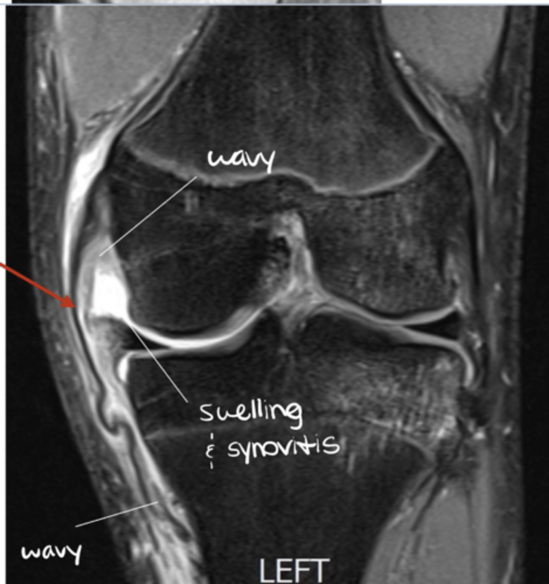 <p>Define the pathology.</p>