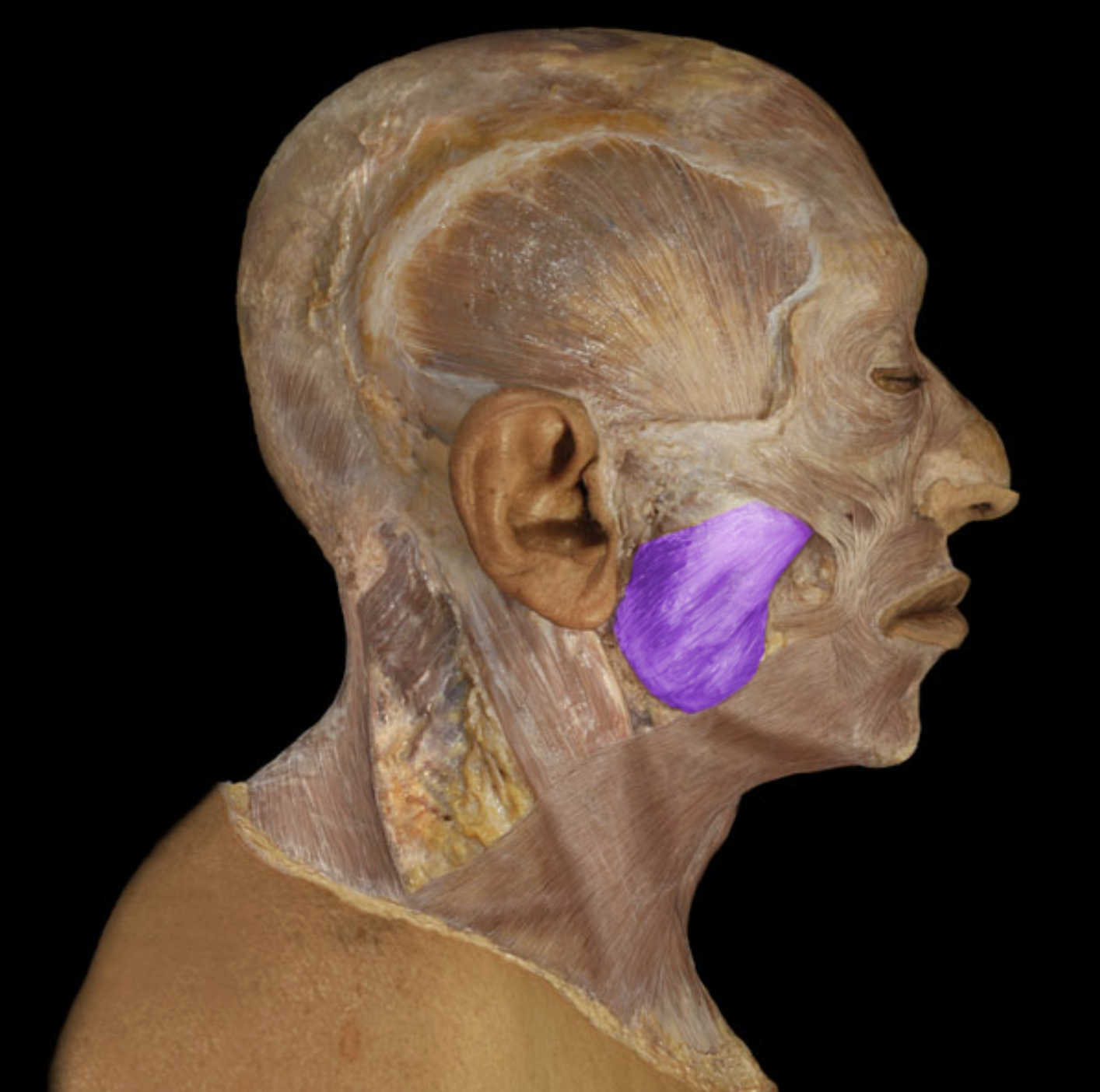 <p>What is/are this muscle’s origin(s)?</p>