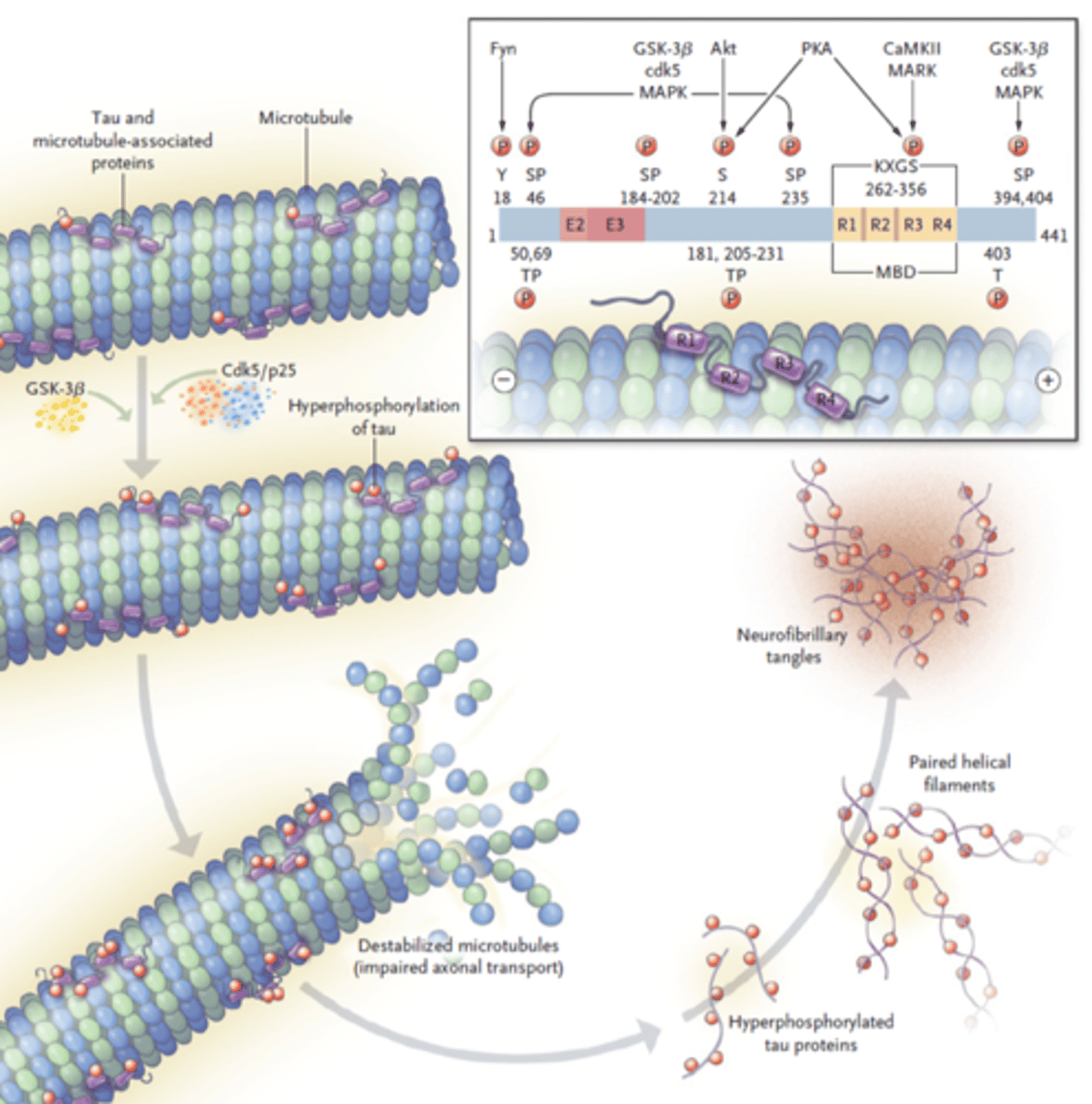 <p>Formed by highly phosphorylated tau protein</p><p>This causes it to disassociated from microtubule. This makes the microtubule unstable as well as promotes association of multiple phosphorylated tau proteins</p><p>Aggregated tau proteins results in fibrils which can lead to tangles which causes the neuron to die</p>