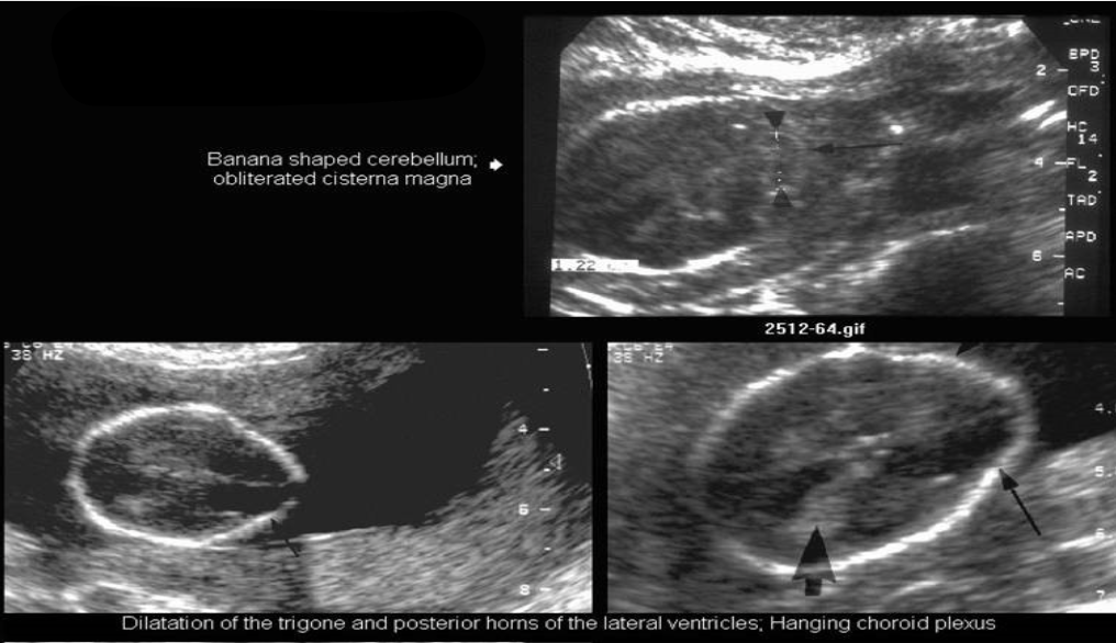 <p>What pathology is being shown?</p>
