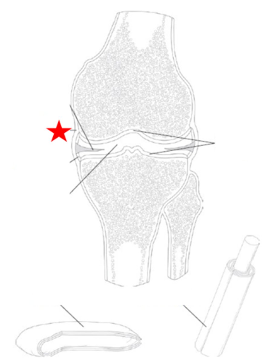 <p>Identify the synovial joint structure that the star is pointing to.</p>