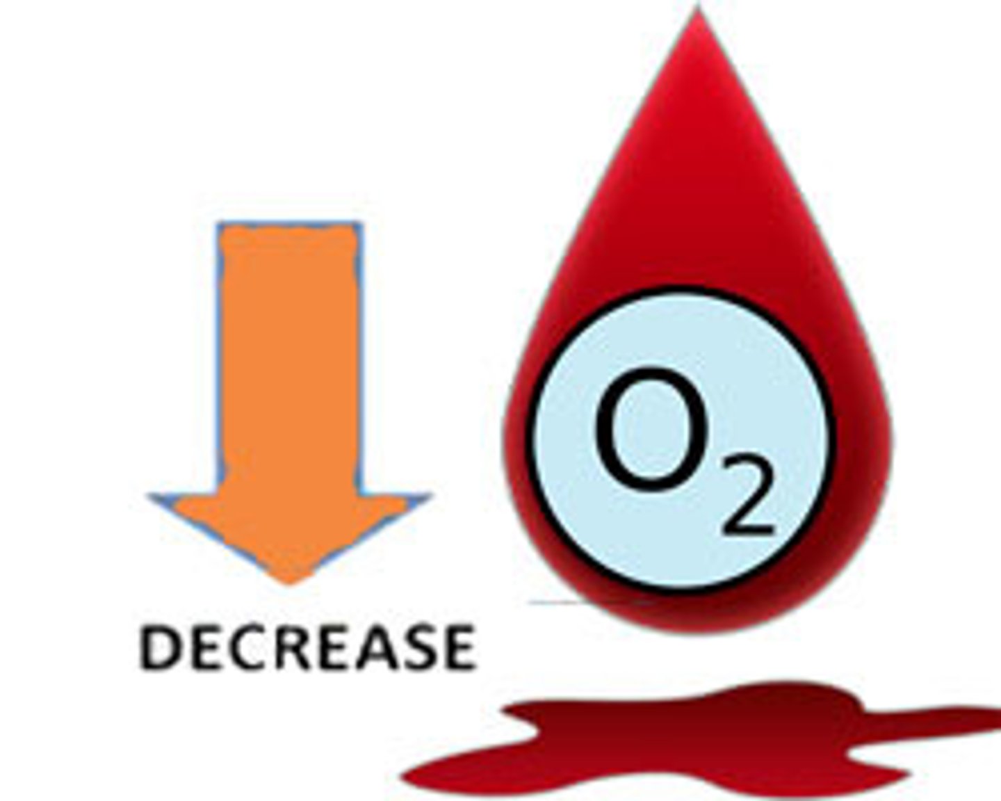 <p>- inflammation</p><p>- hypoxemia/hypoxia = ischemia</p><p>- electrolyte dysfunction</p><p>- free radicals</p>